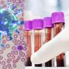Covid-19 virus. scientist analyzing of coronavirus.